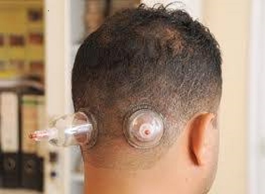 مركز الإرادة للعلاج الطبيعي - معدات العلاج الحديثة